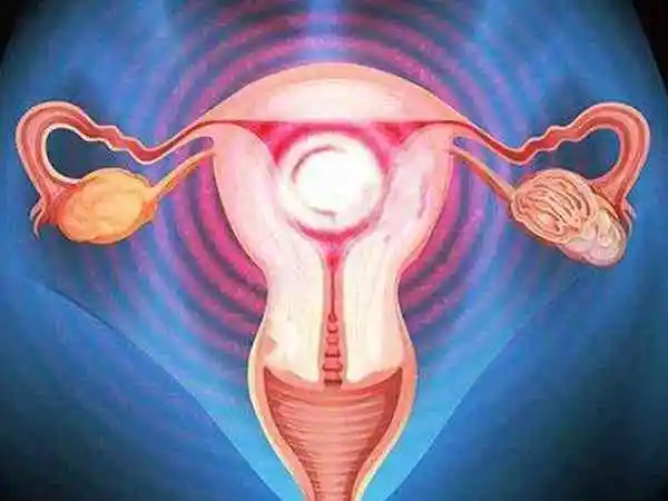 子宫腺肌症怀孕后保胎的方法是什么(图1)